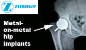 Georgia Zimmer Hip Replacement Recall Lawyer